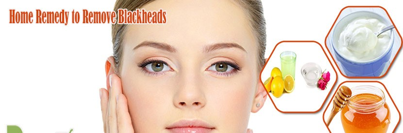 10 Best Natural Remedies For Removing Blackheads | Easy Home Remedies ...